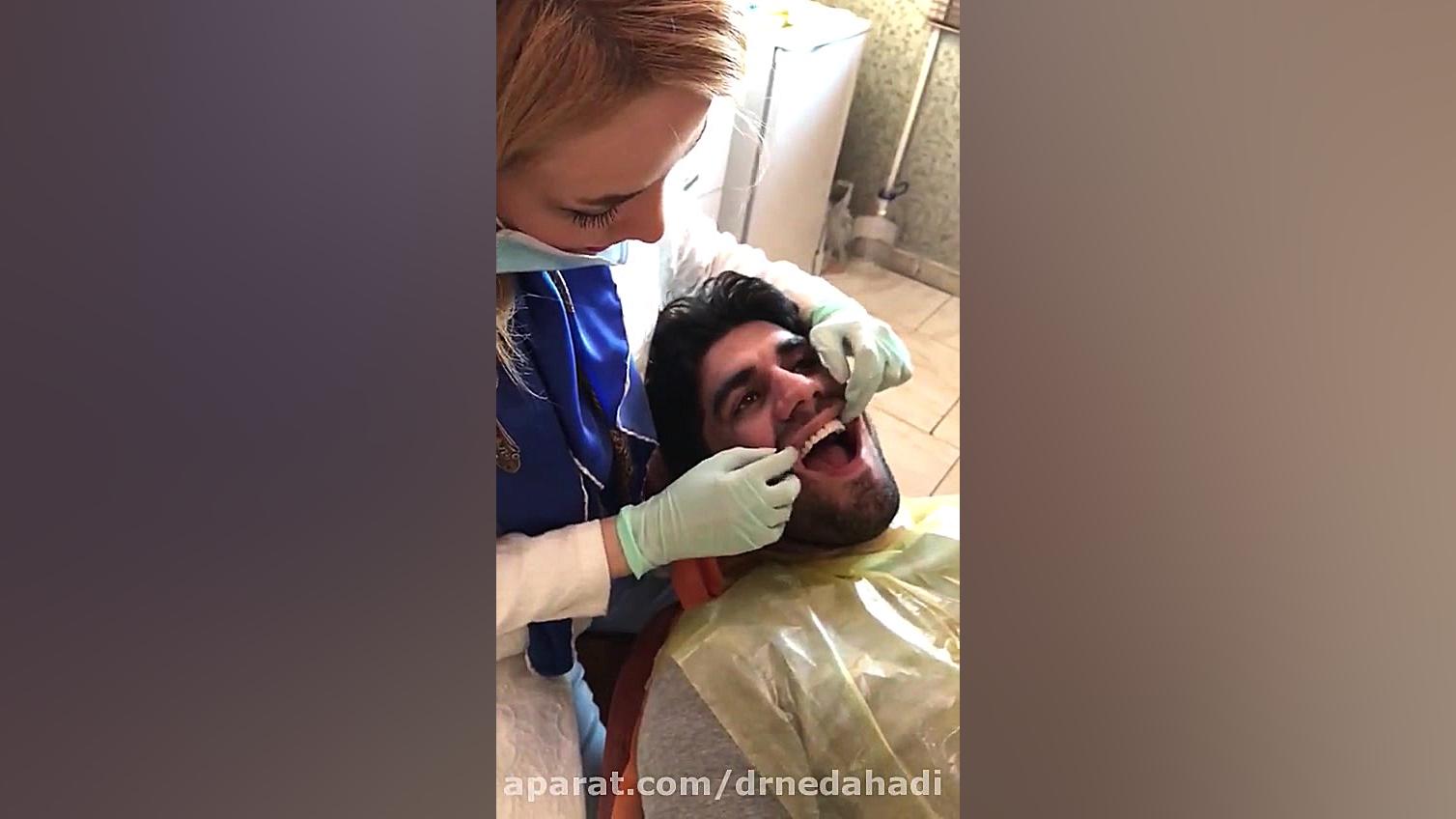 بازسازی دندان به وسیله روکش2 | دکتر ندا هادی دکتر ندا هادی-دندانپزشک زیبایی