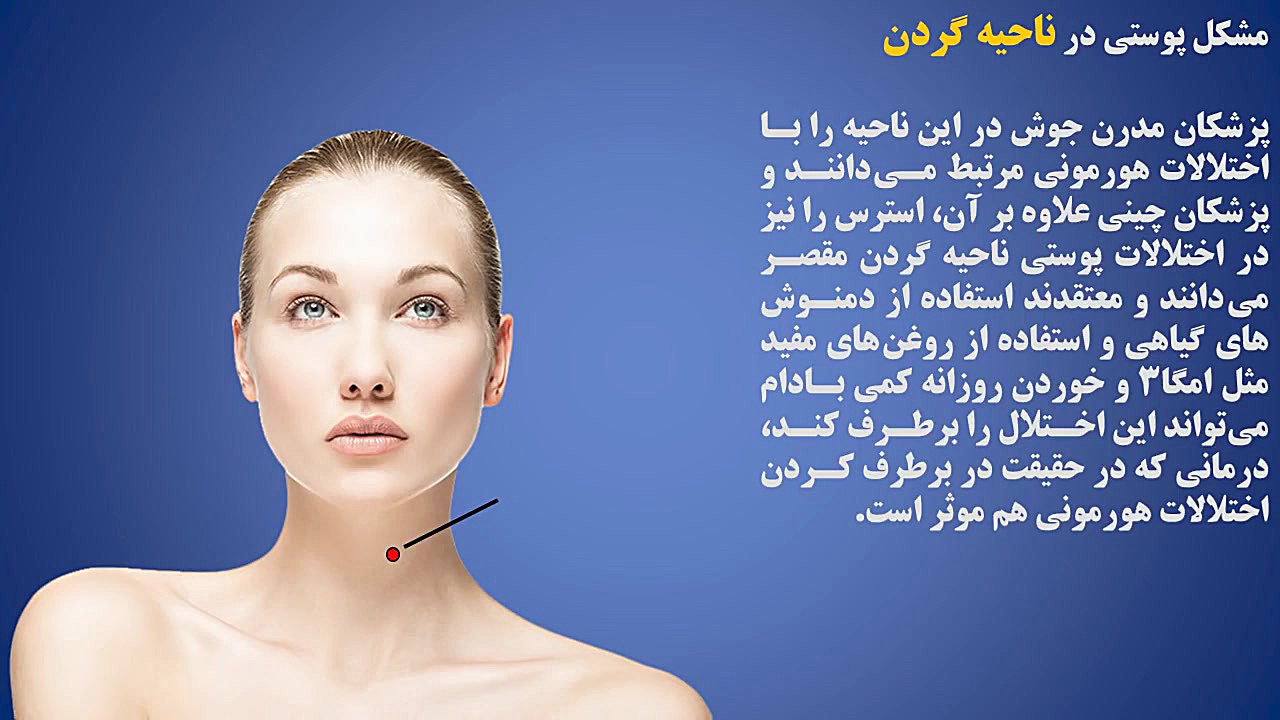از روی جوش صورت بیماریها را تشخیص دهید رفع غبغب