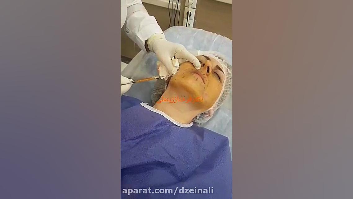 تزریق چربی از شکم به صورت مهندسی ژنوم انسانی
