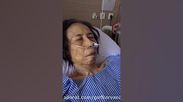 بازگشت تکلم در بیماران سکته مغزی.09120452406بیگی.حرف زدن بیماران سکته مغزی. جراحی فک