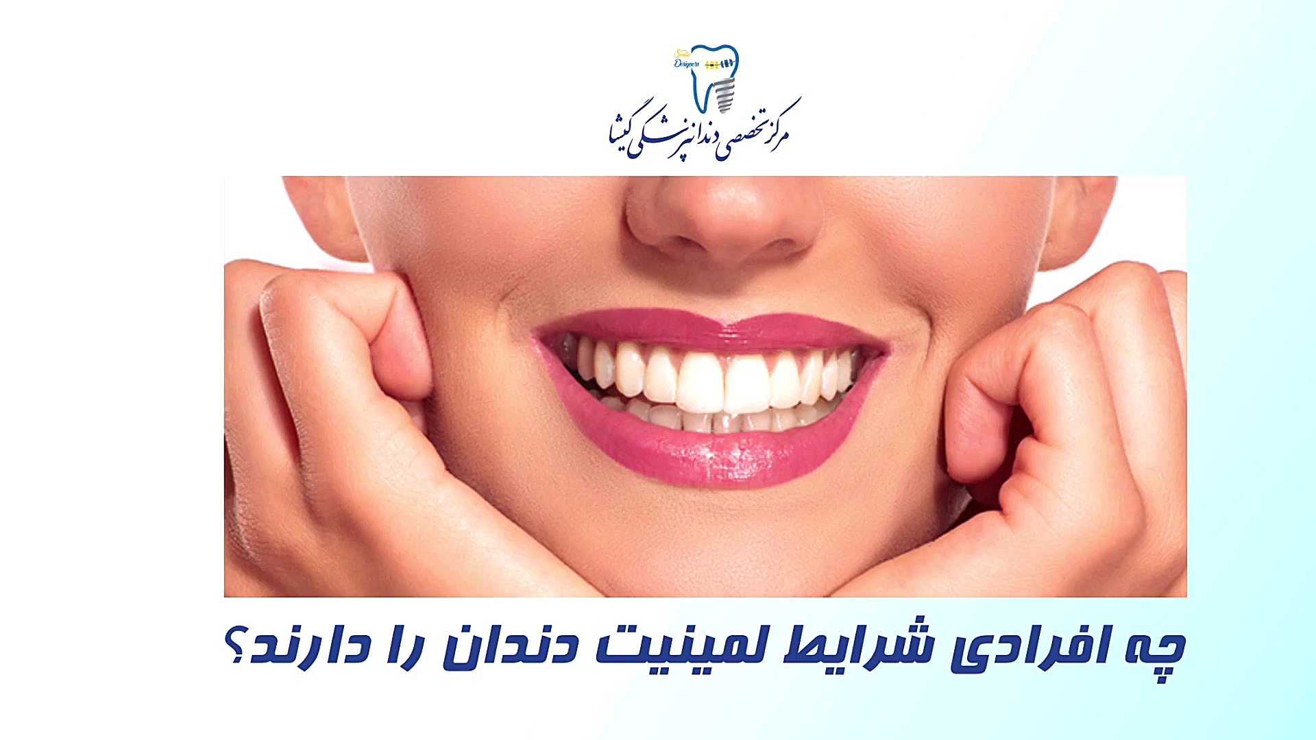 چه افرادی شرایط لمینت کردن دندان را دارند؟ کلینیک دندانپزشکی دکتر عزیز گشاده رو