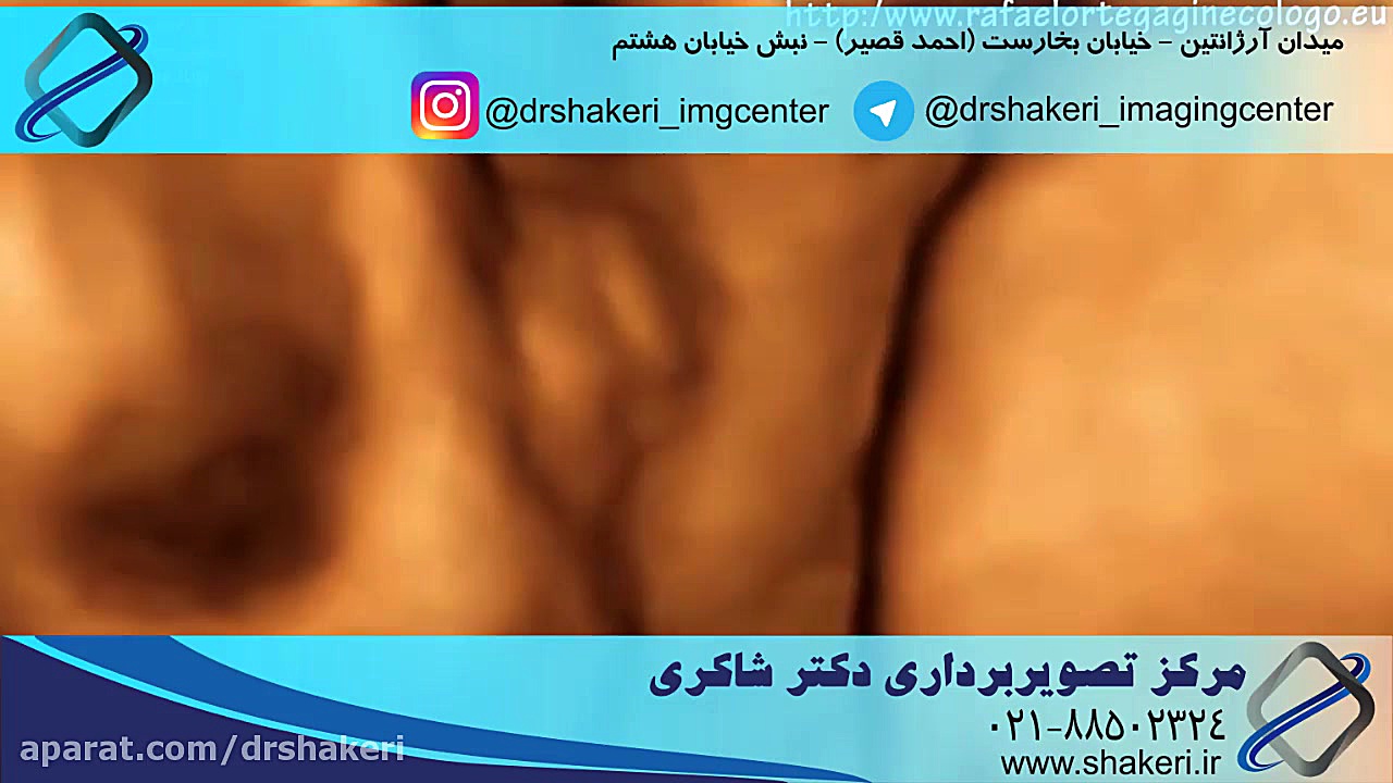 سونوگرافی چهار بعدی / مرکز تصویربرداری دکتر شاکری پر کردن دندان