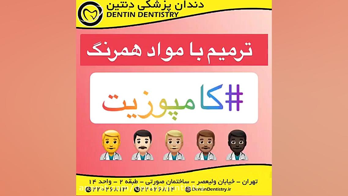 ترمیم با مواد همرنگ (کامپوزیت) دندانپزشکی دنتین دکتر محسن عابدلو