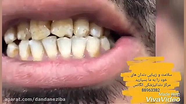 بهترین دندانپزشک تهران | بهترین دندانپزشک زیبایی در تهران درمان سلولیت