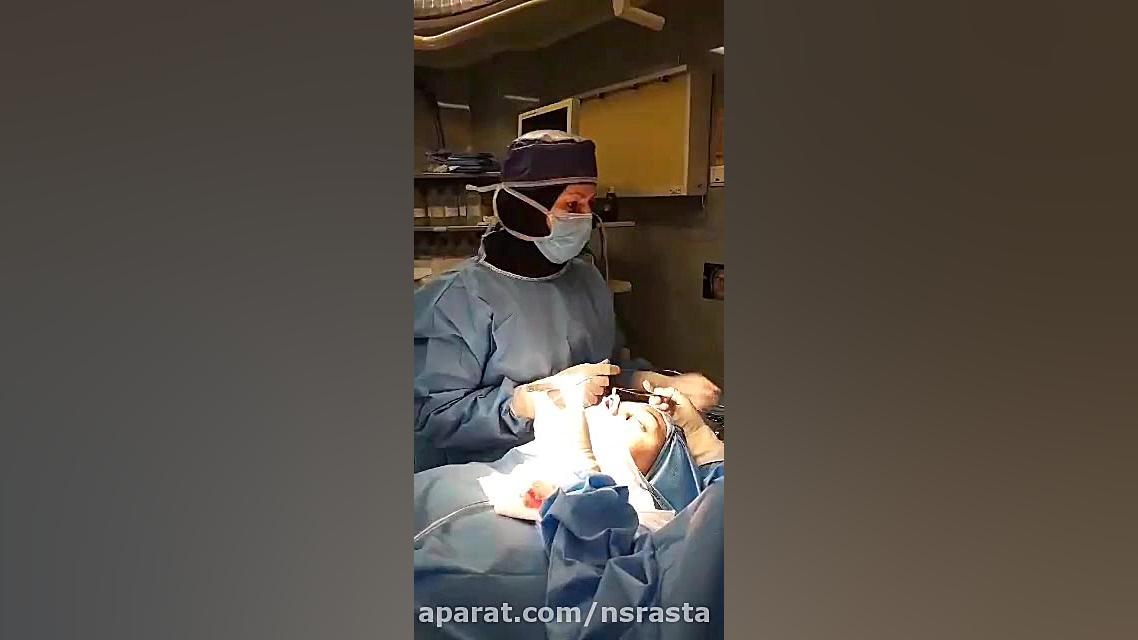 نترسید از اتاق عمل! جراحی بینی زنده!Live! منافذ باز پوست