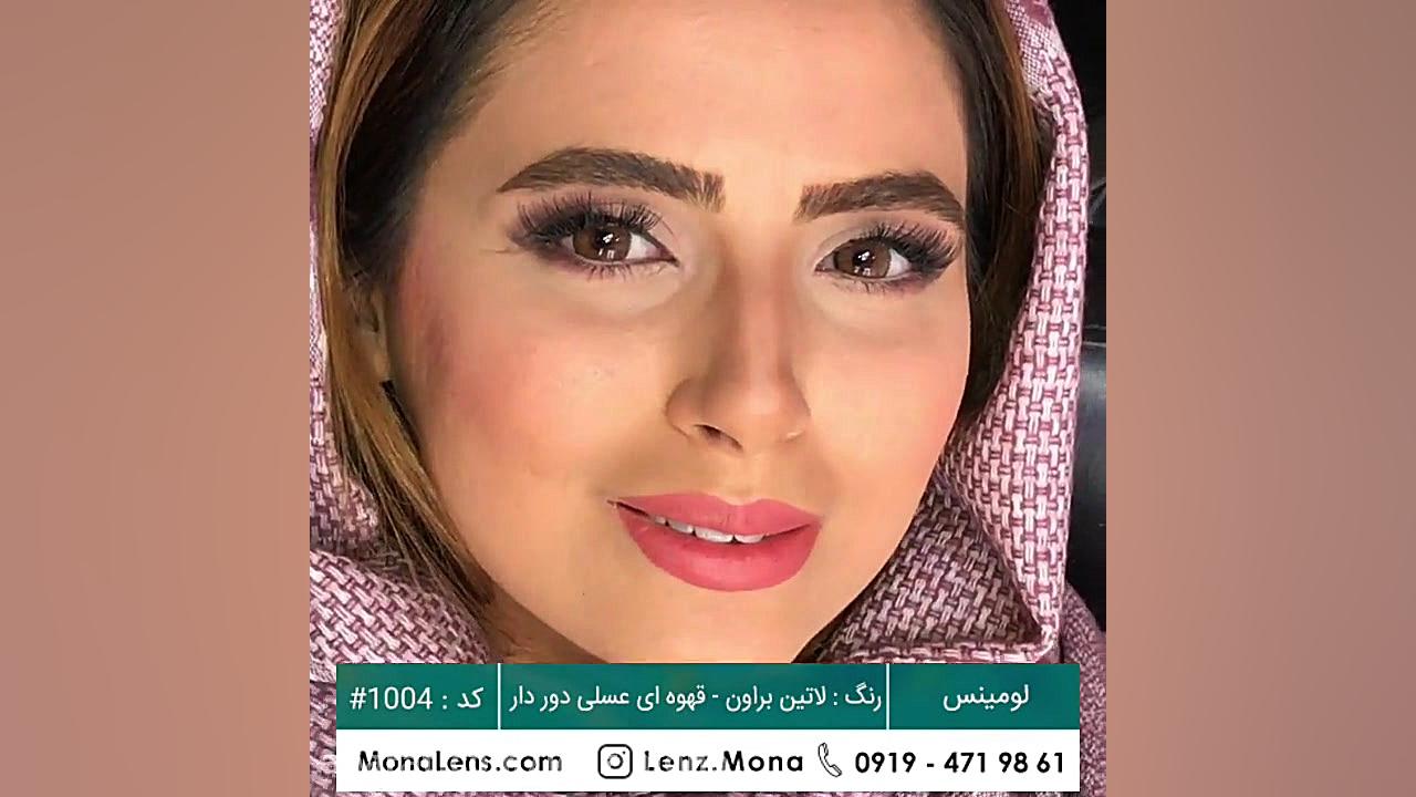 لنز مونا-لومینس-رنگ لاتین براون- قهوه ای عسلی دور خط دار- کد #100۴ بیماری استئوجنز ایمپرفکتا