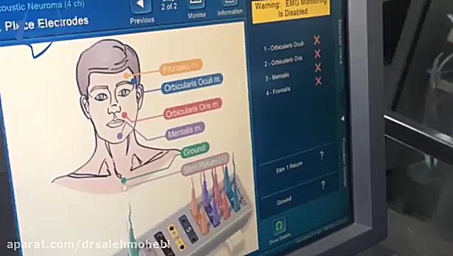 جراحی قاعده جمجمه سیستم مانیتورینگ عصب جراحی زیبایی پلک
