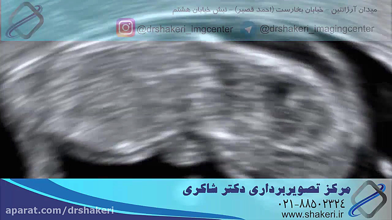 سونوگرافی 2، 3 و 4 بعدی- کالرداپلر / مرکز تصویربرداری دکتر شاکری علیرضا قربانی