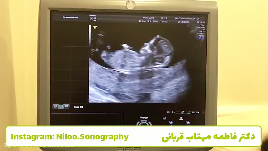 روز شنبه و جنین