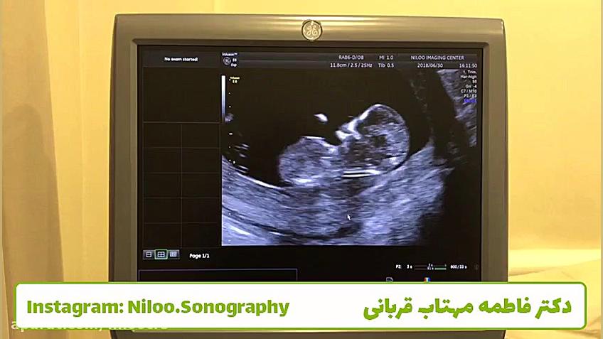 روز شنبه و جنین سونوگرافی نیلو دکتر فاطمه مهتاب قربانی