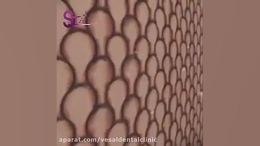 نقش تغذیه بر روی سلامت دندان ها تزریق بوتاکس