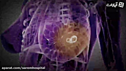 سرطان سینه را جدی بگیرید