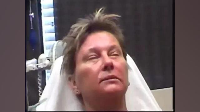 مزوتراپی زیر چشم دکتر حسین احمدی