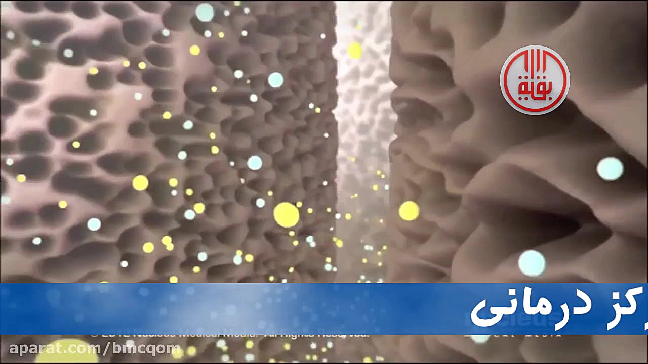 دیالیز ترمیم لبخند لثه‌ای