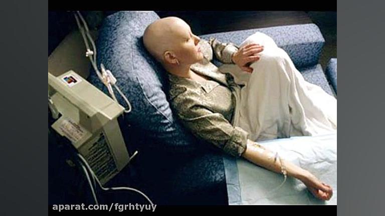 تجربه درمان سرطان بدون شیمی درمانی جراحی بینی