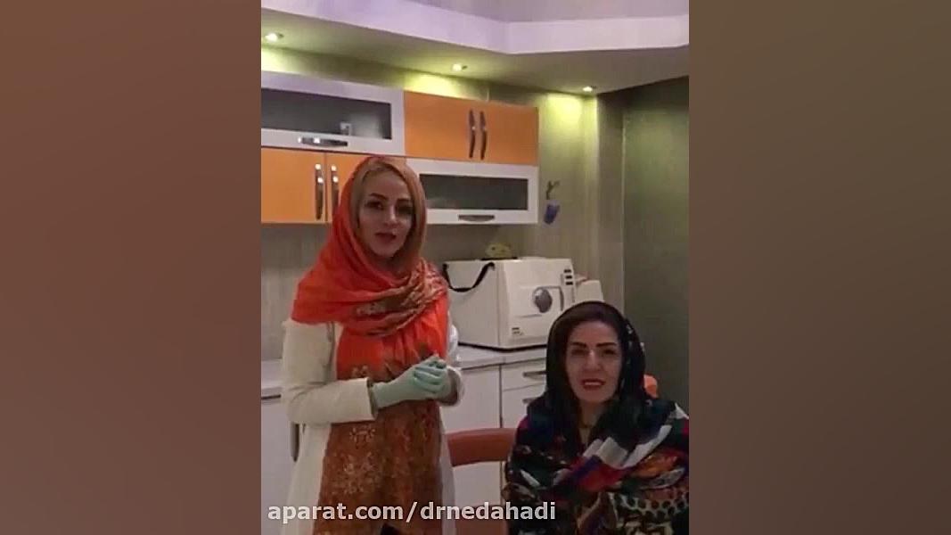 اصلاح طرح لبخند | دکتر ندا هادی دندانپزشک زیبایی و ترمیمی دکتر ندا هادی-دندانپزشک زیبایی