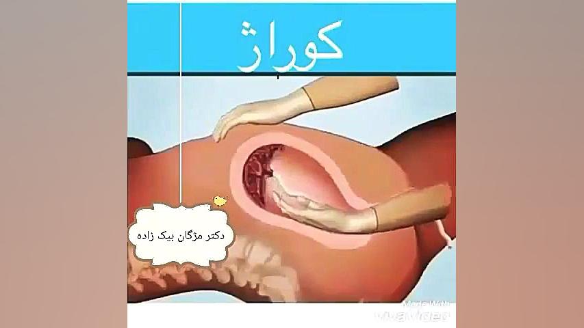 کورتاژ دکتر مژگان بیک زاده ( جراح و متخصص زنان و زایمان)