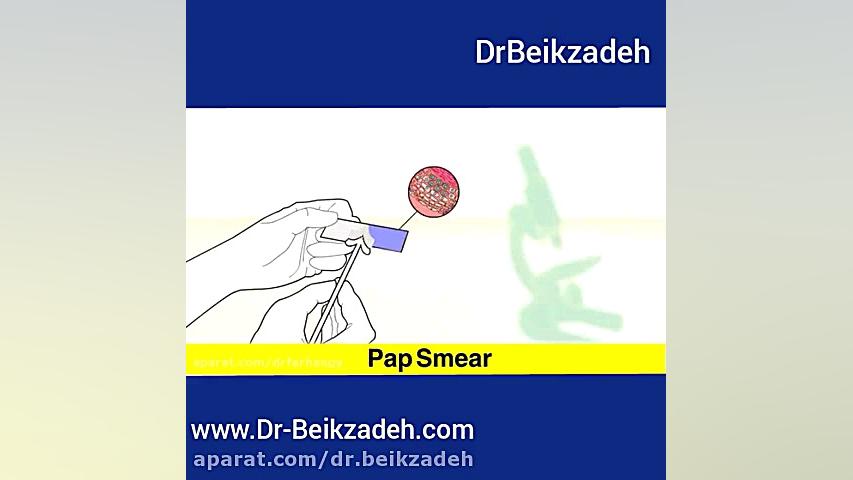 تست پاپ اسمیر دکتر مژگان بیک زاده ( جراح و متخصص زنان و زایمان)