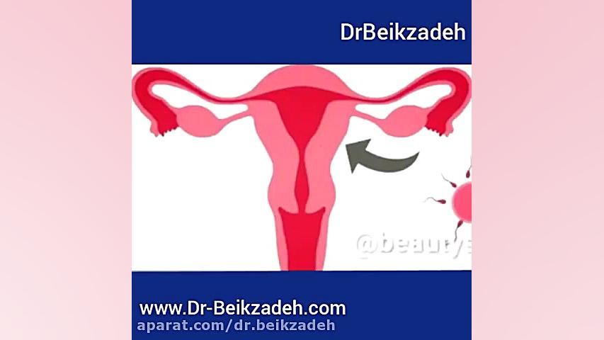 نکاتی در مورد پریودی دکتر مژگان بیک زاده ( جراح و متخصص زنان و زایمان)