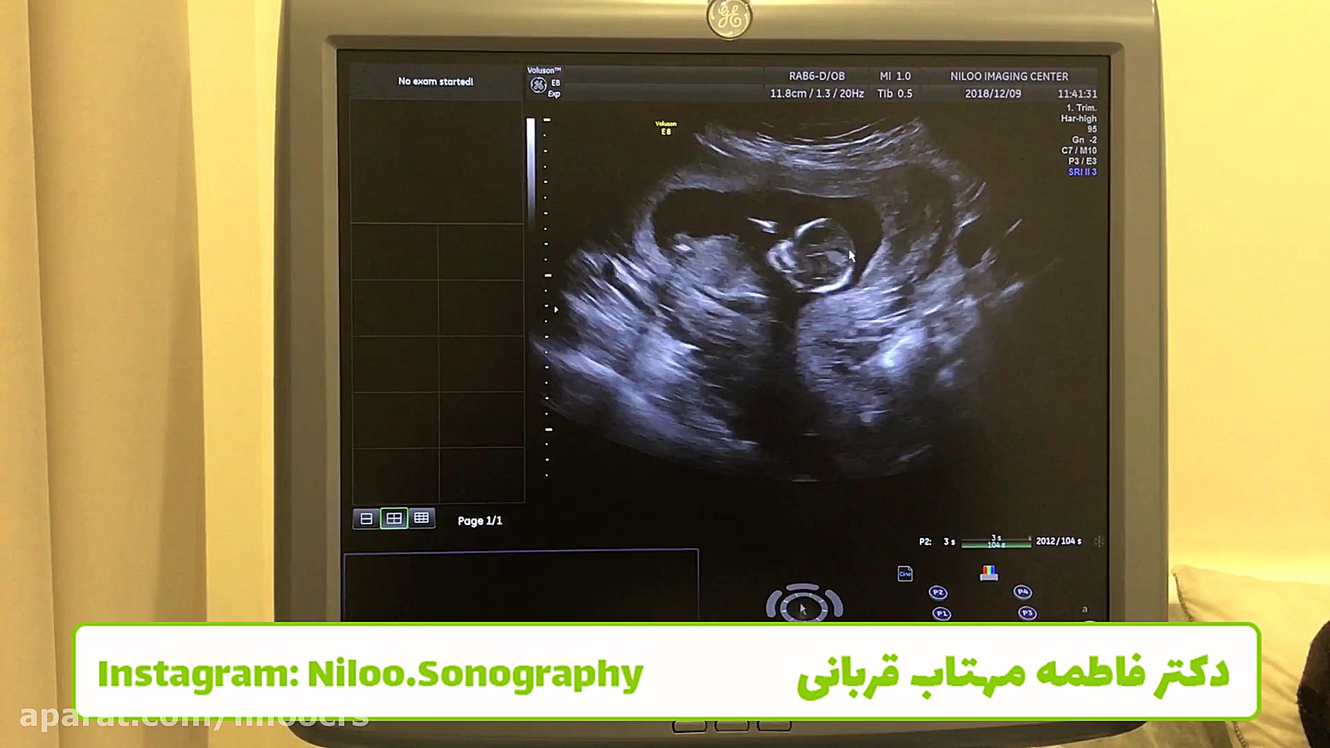بارداری چند قلویی سونوگرافی نیلو دکتر فاطمه مهتاب قربانی