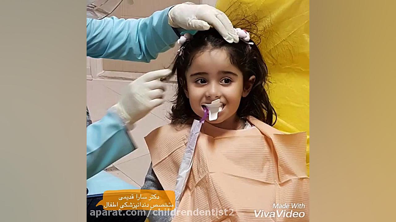 فلورایدتراپی دکتر سارا قدیمی