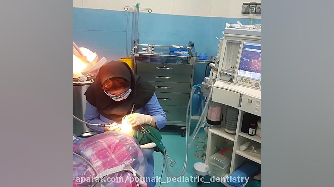 درمان دندان کودکان غیرهمکار با بیهوشی ترمیم سوختگی