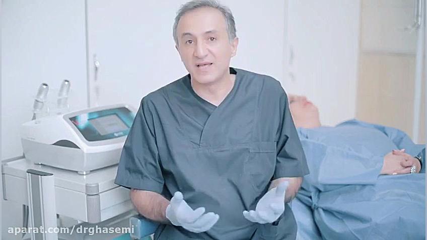چه افرادی برای هایفوتراپی مناسب هستند ؟ دکتر علی قاسمی(پوست ، مو ، زیبایی )