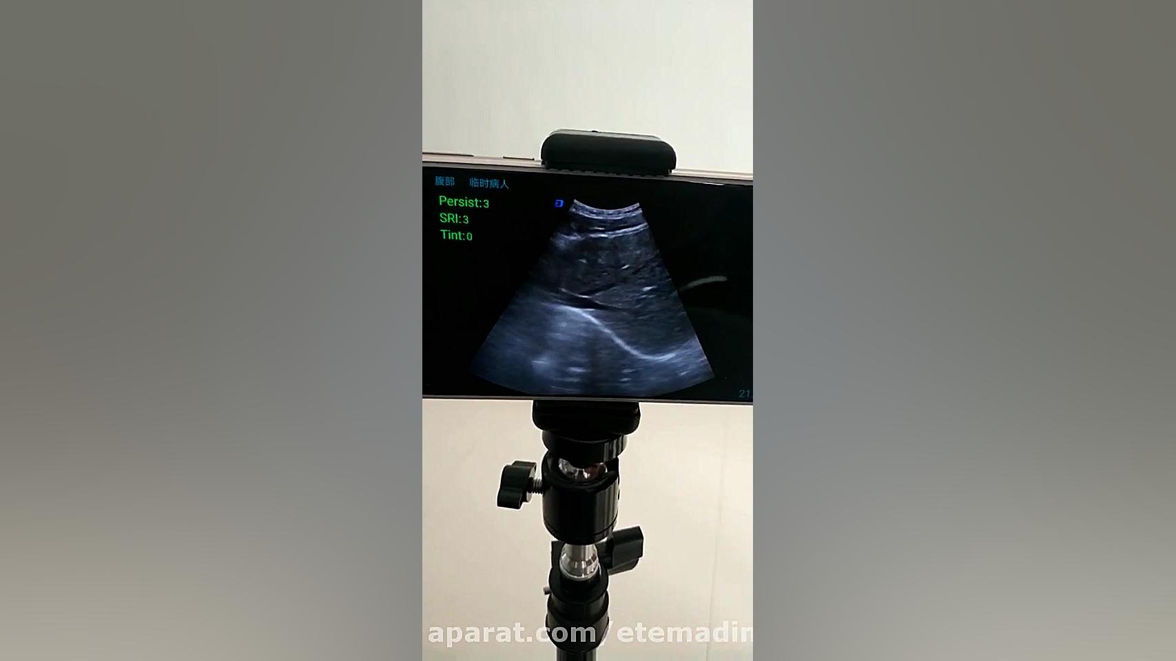 دستگاه سونوگرافی پرتابل مدل DW-3 کلینیک لیزر