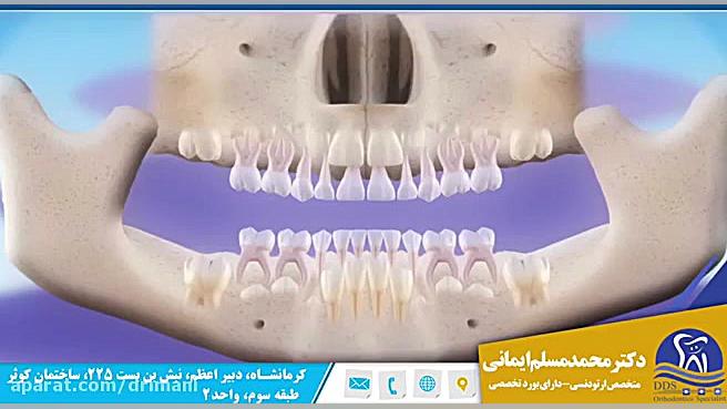 روند جایگزینی دندان های شیری با دندان های دائمی دکتر محمد مسلم ایمانی - متخصص ارتودنسی در کرمانشاه