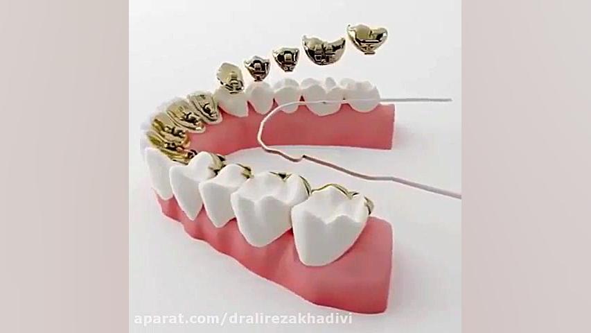 ارتودنسی لینگوال دکتر علیرضا خدیوی