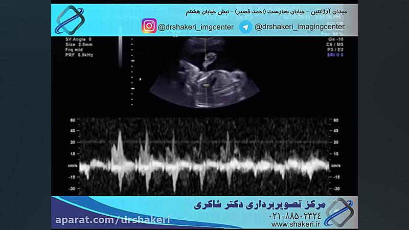 سونوگرافی 2 و 4 بعدی (هفته 25) / مرکز تصویربرداری دکتر شاکری سلنا گومز