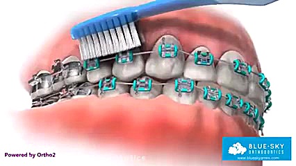 دکتر ابراهیم عینی ارتودنسی اهواز نحوه صحیح مسواک زدن دکتر ابراهیم عینی