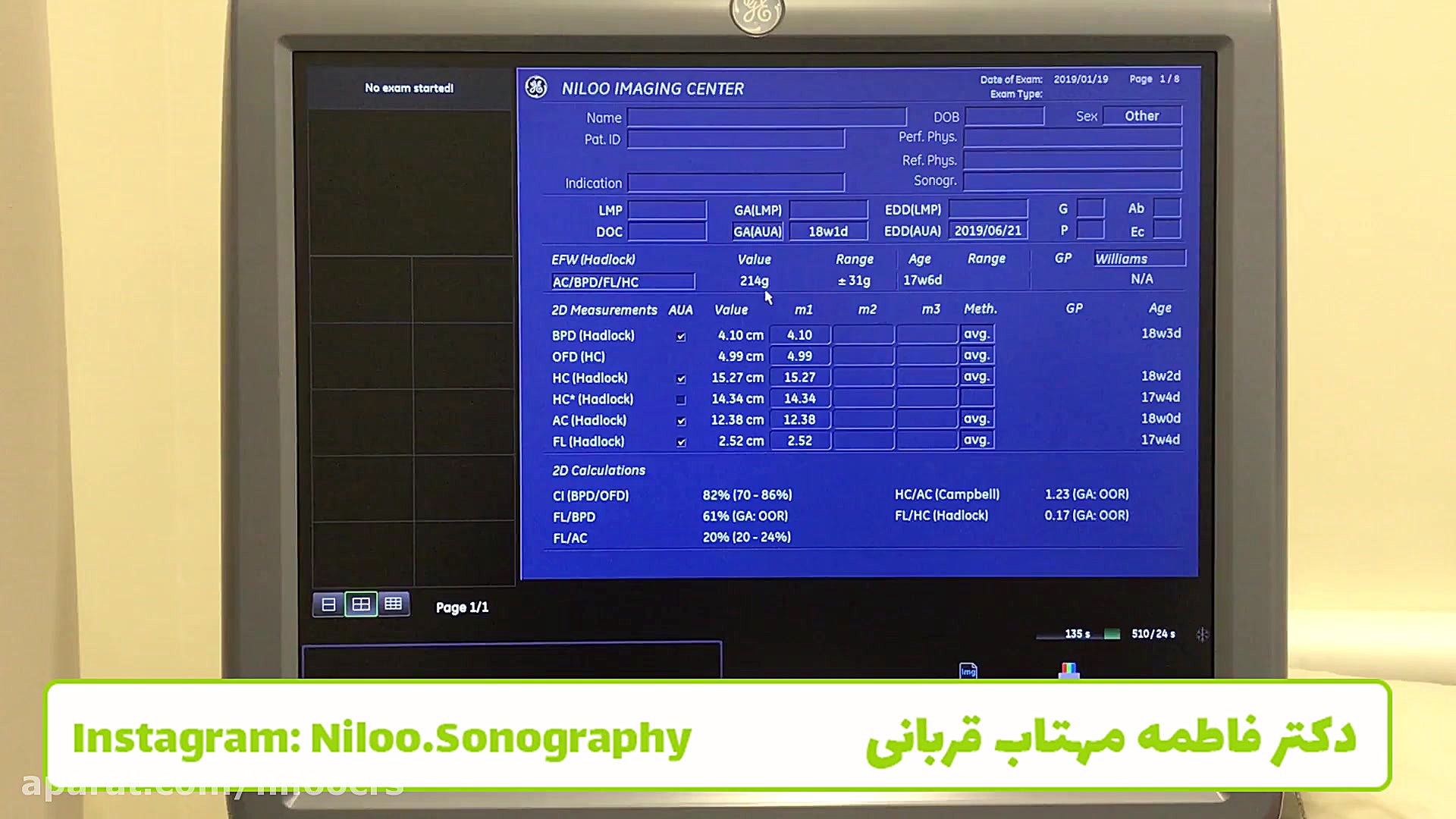 وزن گیری جنین سونوگرافی نیلو دکتر فاطمه مهتاب قربانی
