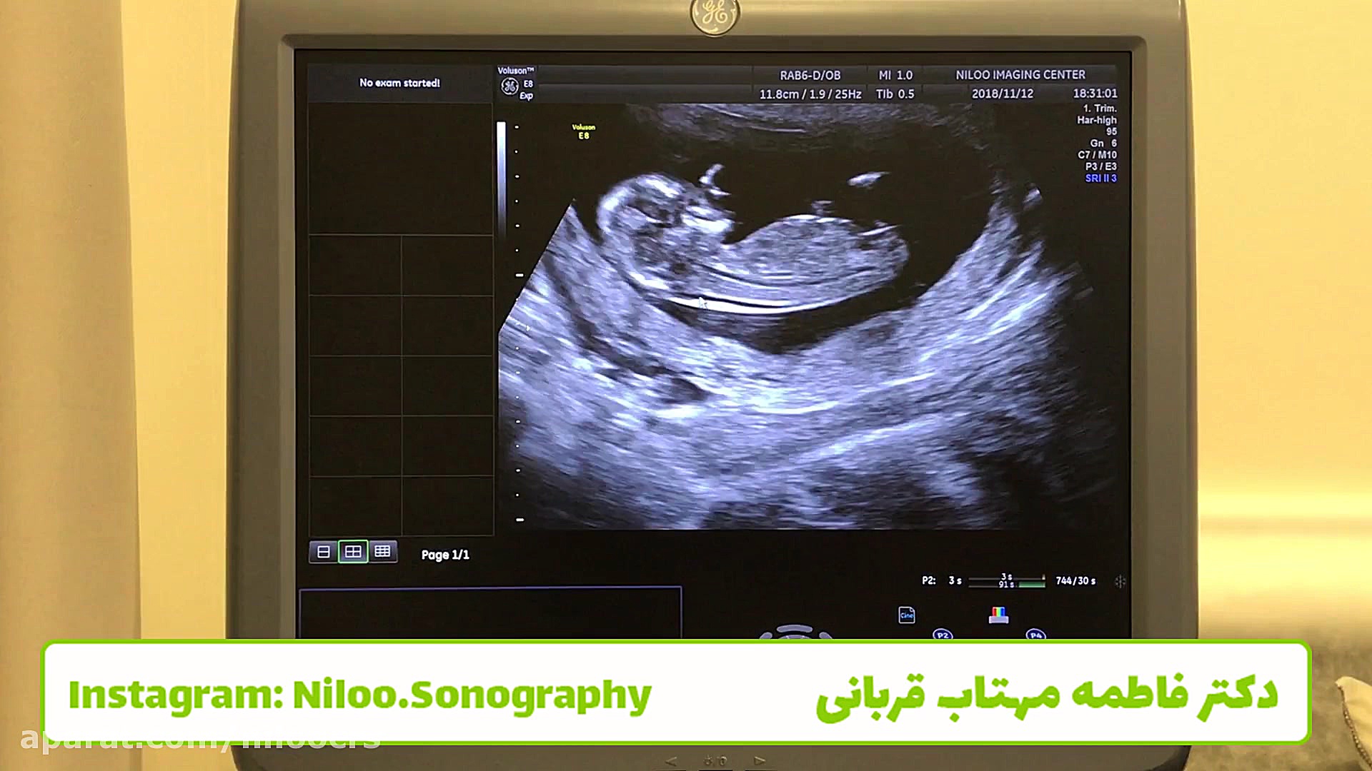 تعیین جنسیت یا سلامت سونوگرافی نیلو دکتر فاطمه مهتاب قربانی