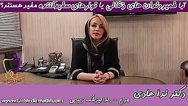 خمیر دندان های ذغالی یا نوارهای سفید کننده دکتر ندا هادی-دندانپزشک زیبایی