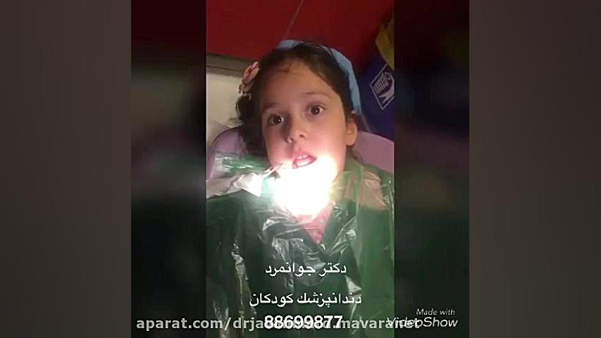 عصب کشی و روکش دندان های شیری فرزاد فرزین