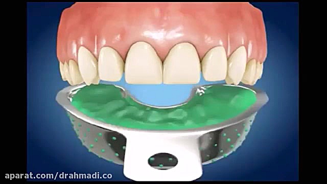 با بلیچینگ دندان هایتان را سفید کنید Autophagy Detection Kit