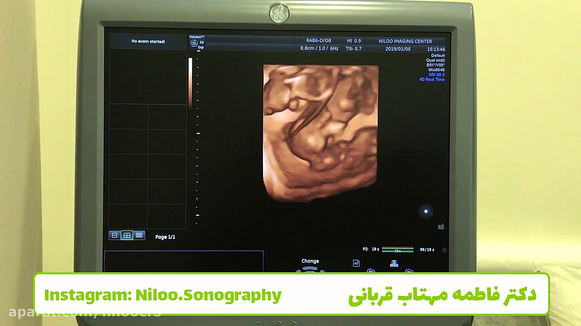 بارداری سه قلویی سونوگرافی نیلو دکتر فاطمه مهتاب قربانی