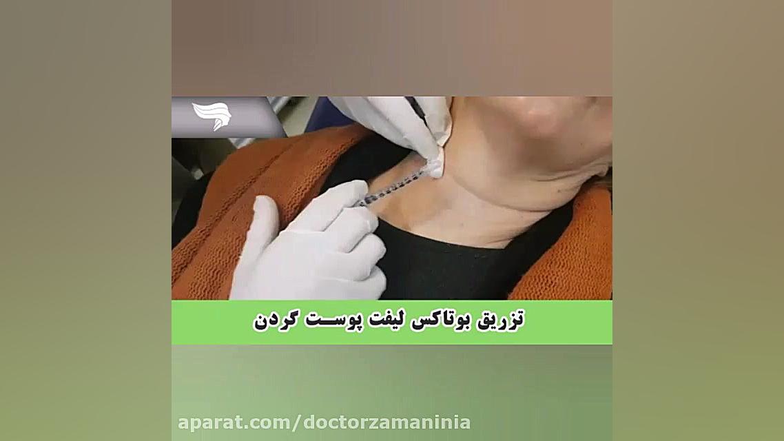 لیفت گردن بیماری کیانسروماتوز صفاقی