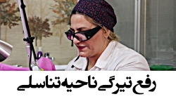 سفید کردن واژن با لیزر