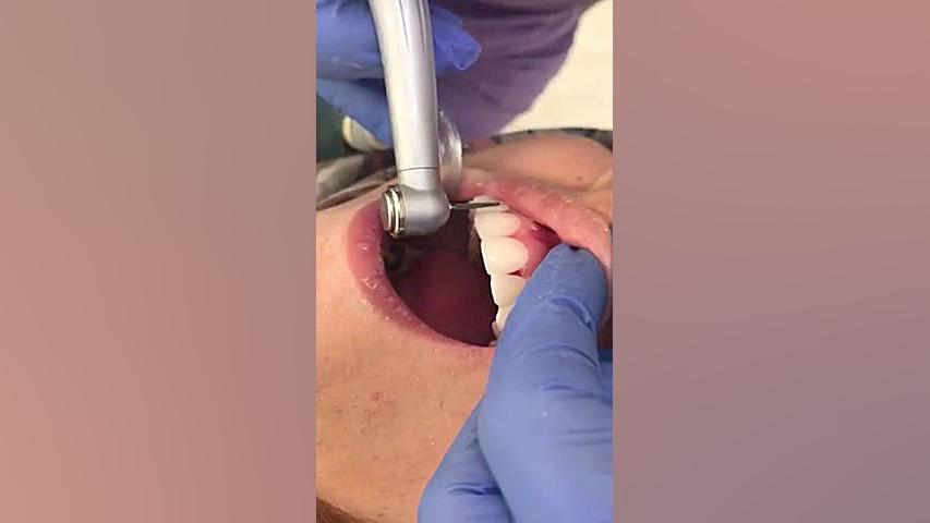 اصلاح طرح لبخند دكتر اولدوز حسینی گلوسودینیا