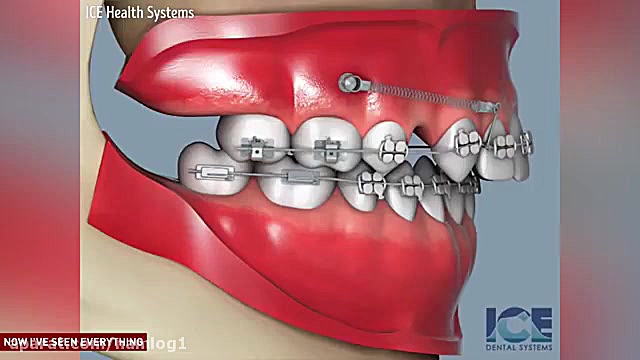 ارتودنسی دندان | کلینیک دندانپزشکی تاج بیورآکتور سه‌بعدی