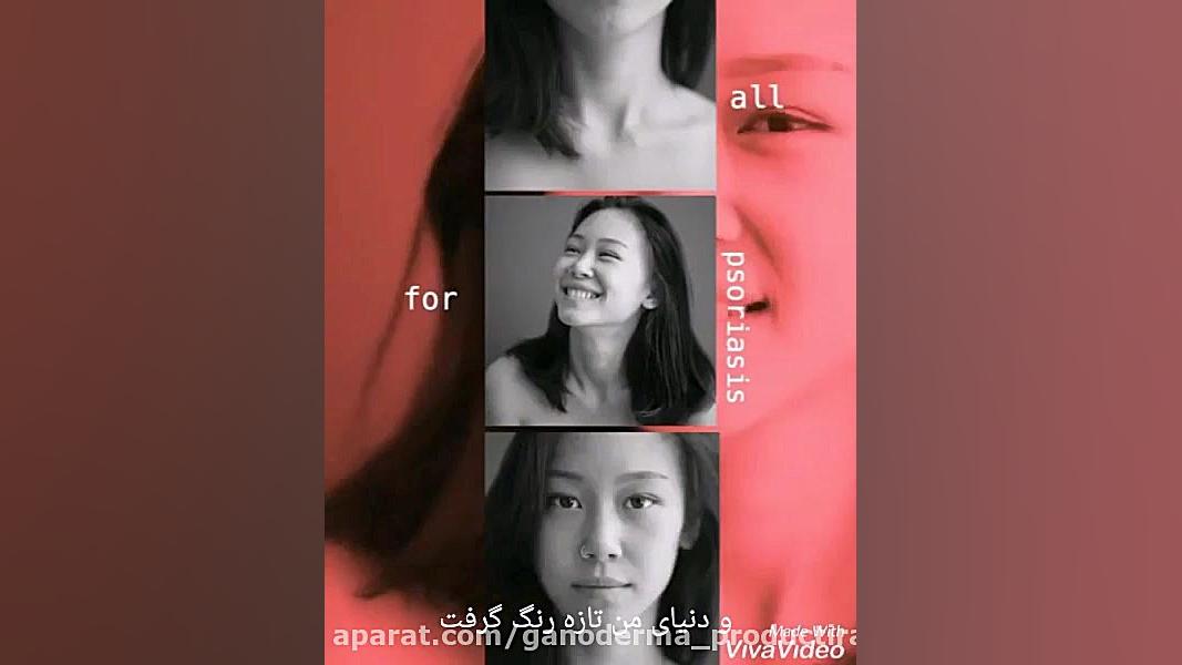 گانودرما و درمان پسوریازیس پله