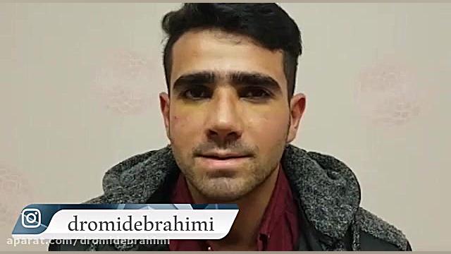 جراحی بینی استخوانی قوز دار توسط دکتر امید ابراهیمی دکتر امید ابراهیمی