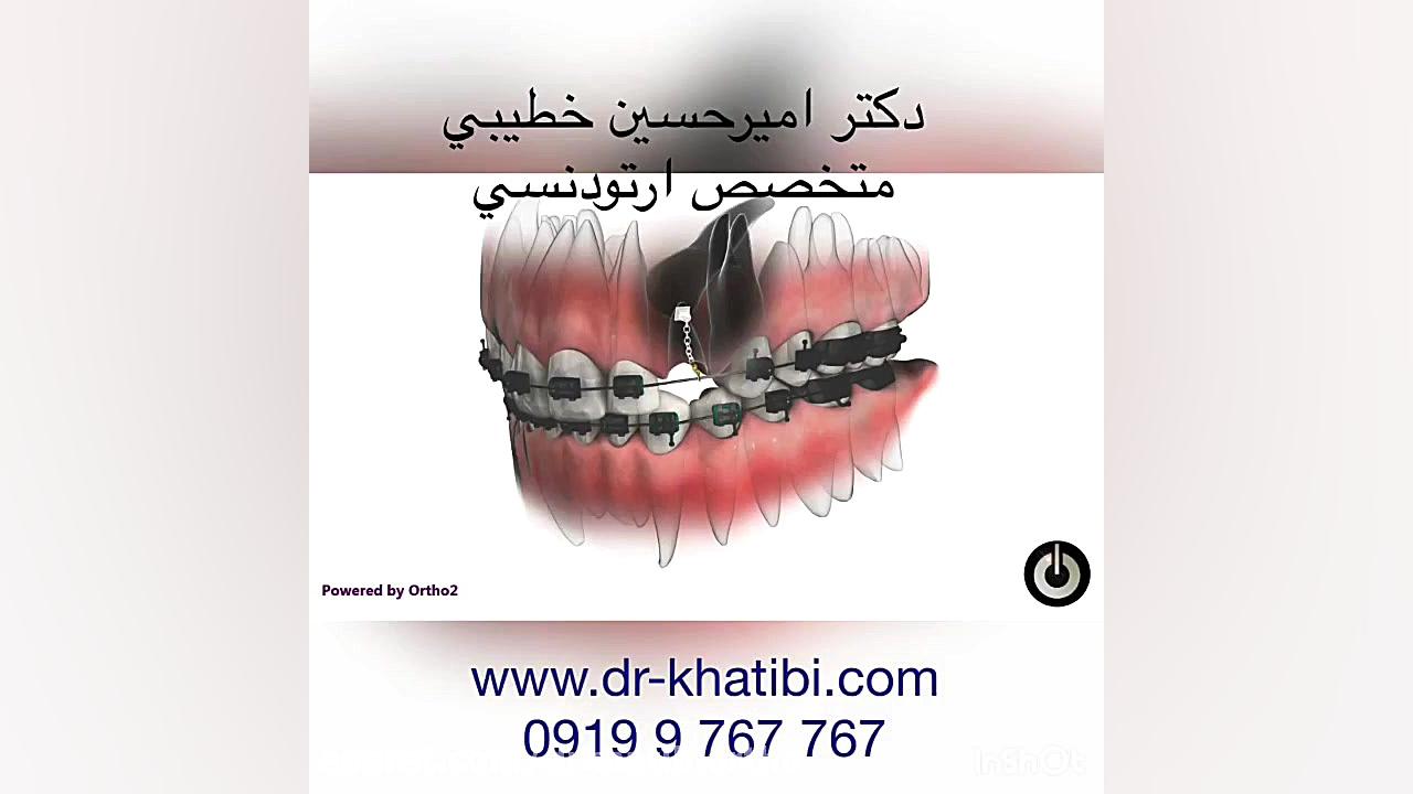 دندان نهفته دکتر امیرحسین خطیبی