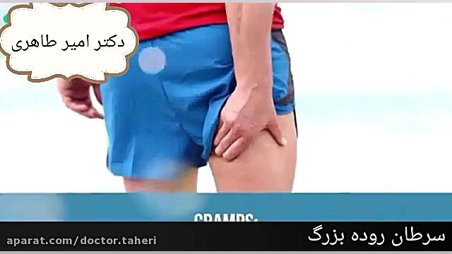 سرطان روده بزرگ | دکتر امیر طاهری پریودنتیکس