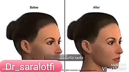 میکرونیدلینگ دکتر سار ا لطفی