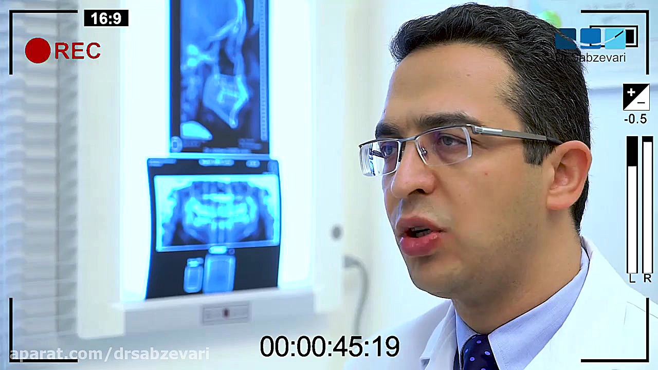 بهداشت دهان و دندان در طی درمان ارتودنسی ثابت دکتر برهمن سبزواری - متخصص ارتودنسی - مشهد