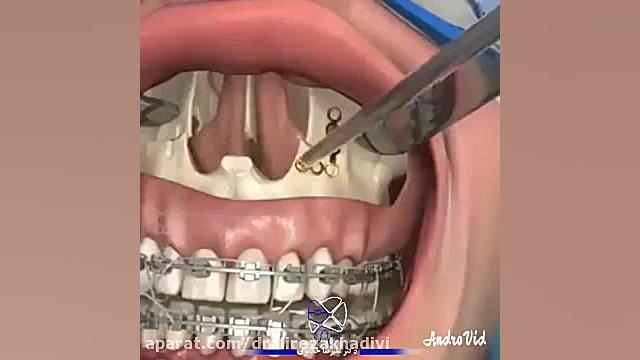 جراحی فک دکتر پوست