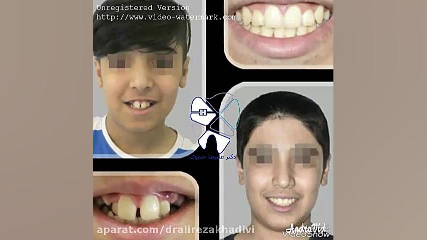 مراجعه به موقع در ارتودنسی دکتر علیرضا خدیوی